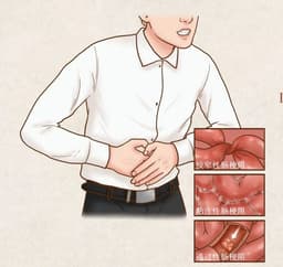便秘会要命！3年3次肠梗阻，他腹胀成球幸终绝处逢生